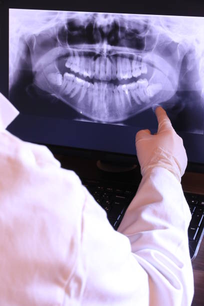 Best Root Canal Emergency Dentist  in Oxnard, CA