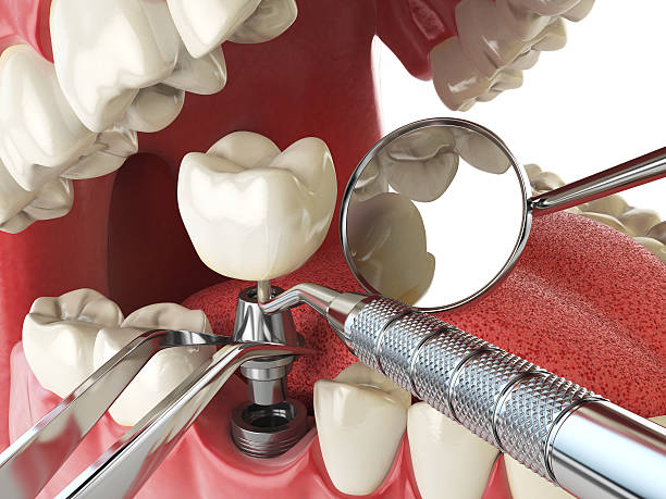 Best Dentist for Tooth Abscess  in Oxnard, CA